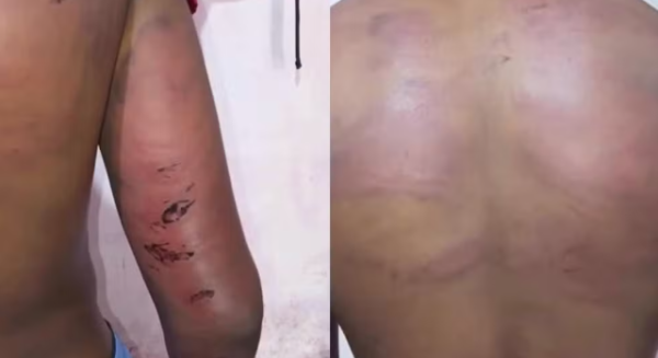 SSP afasta policial após denúncia de tortura contra adolescente no MA