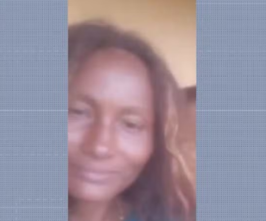 Mulher tem 90% do corpo queimado e marido é preso como principal suspeito no MA