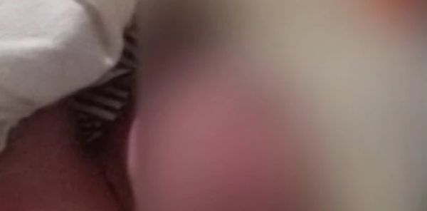 Bebê é encontrado no lixo e socorrido por moradores em São Bento