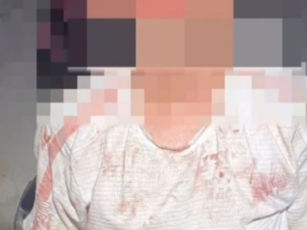 Mulher fica desacordada após agressão do marido em Imperatriz; ele foi preso